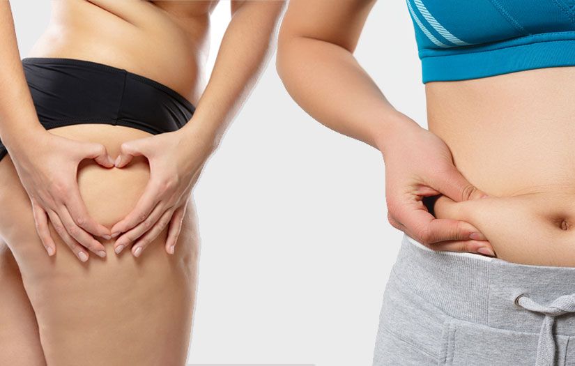 Toronto Body fat removal Clinic